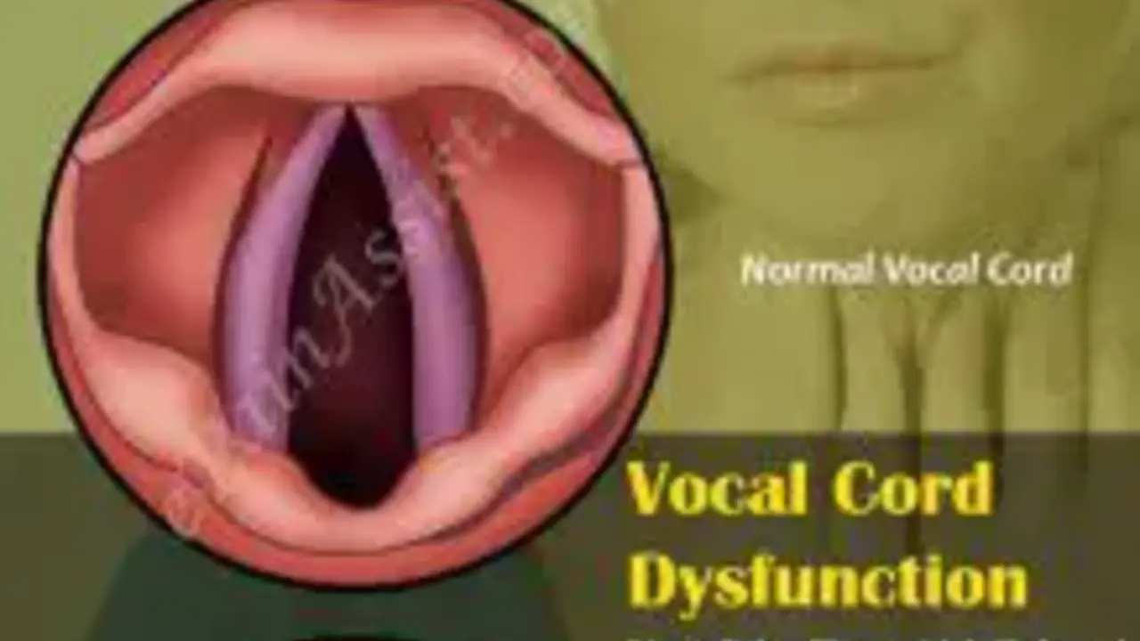 The Connection Between Asthma and Vocal Cord Dysfunction